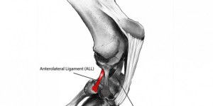 Ligament1-900x450-655x328